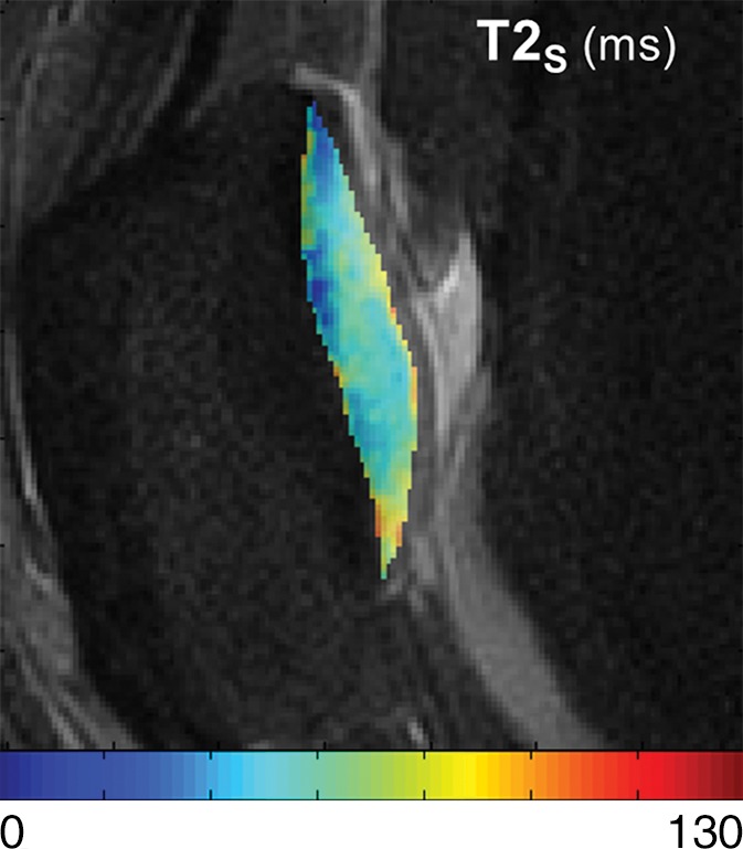 Figure 3d: