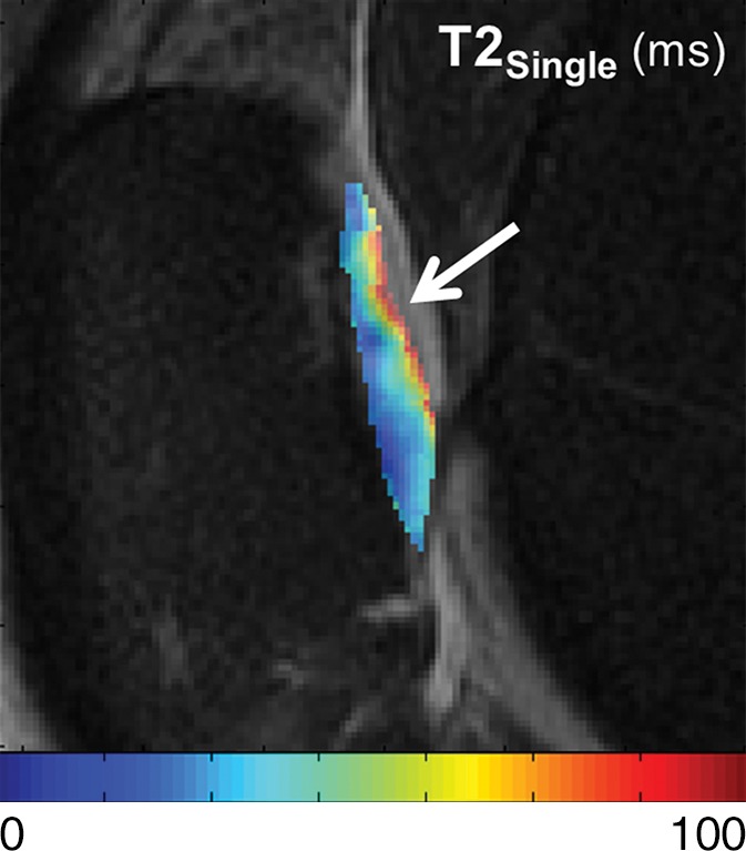 Figure 4b: