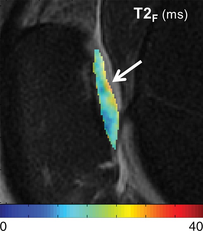 Figure 4c: