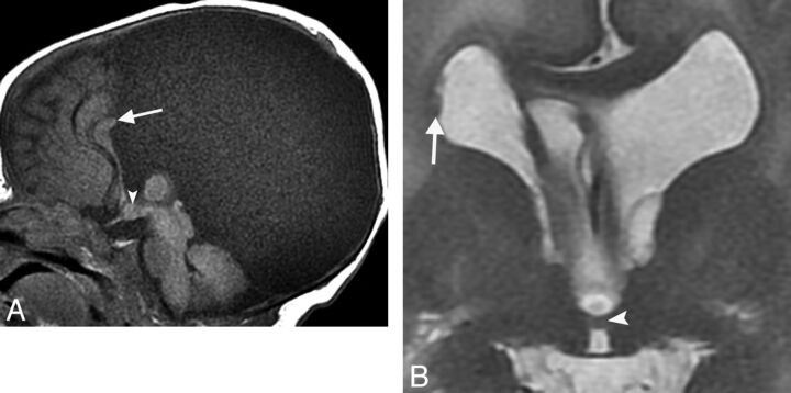 Fig 5.