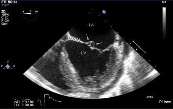 Figure 2a