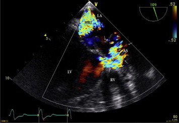 Figure 1c