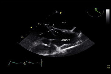 Figure 1a