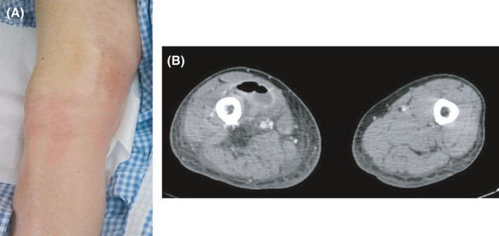 Fig. 2