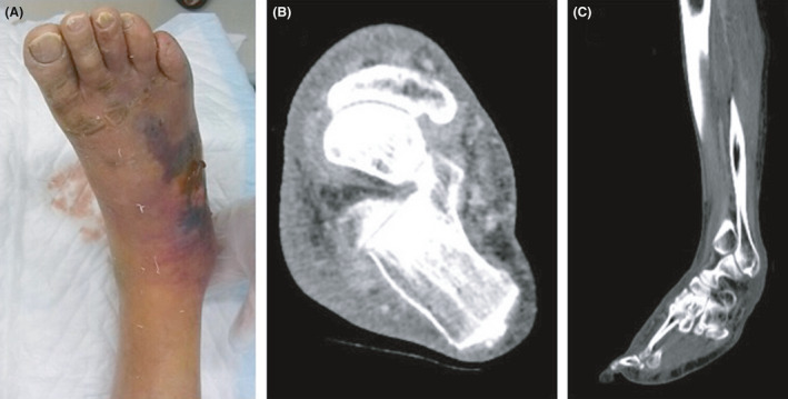 Fig. 1