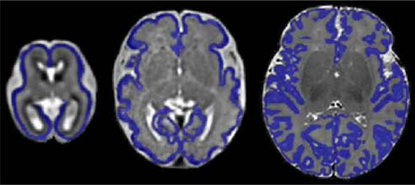 Figure 4: