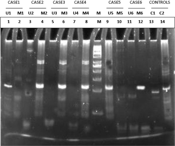 Figure 3A