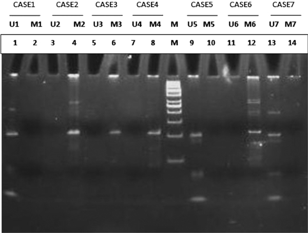 Figure 3B