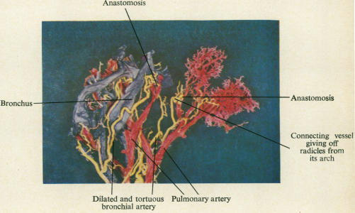 graphic file with name thorax00019-0006-b.jpg