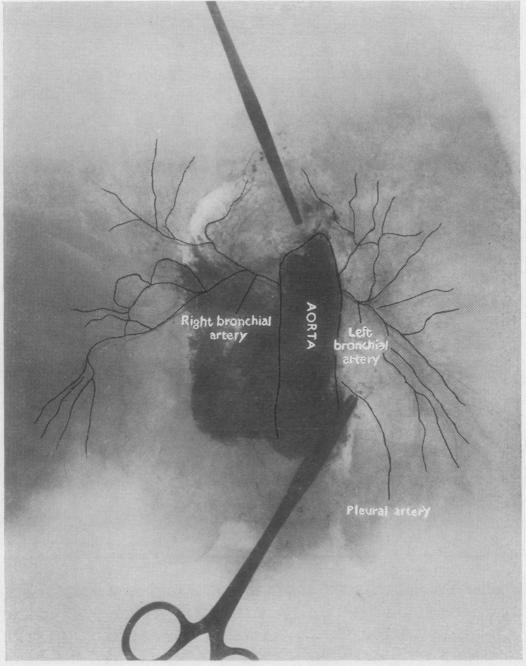 graphic file with name thorax00019-0005-a.jpg