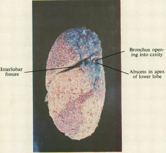 graphic file with name thorax00019-0012-a.jpg