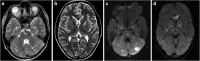 Fig. 24