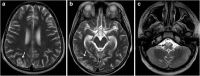 Fig. 16