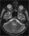 Fig. 17