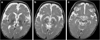Fig. 12