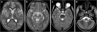 Fig. 19