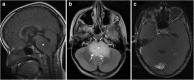 Fig. 25