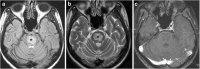 Fig. 11
