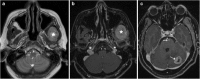 Fig. 30