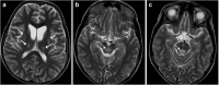 Fig. 14