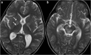 Fig. 15
