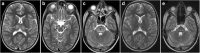 Fig. 20