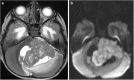 Fig. 29