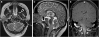 Fig. 27