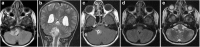 Fig. 22