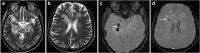Fig. 23