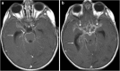 Fig. 21