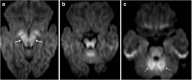 Fig. 13
