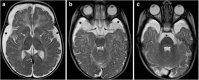 Fig. 18
