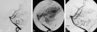 Fig 3.