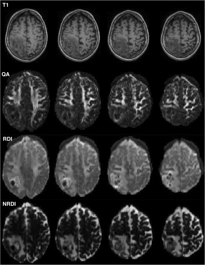 Fig. 5