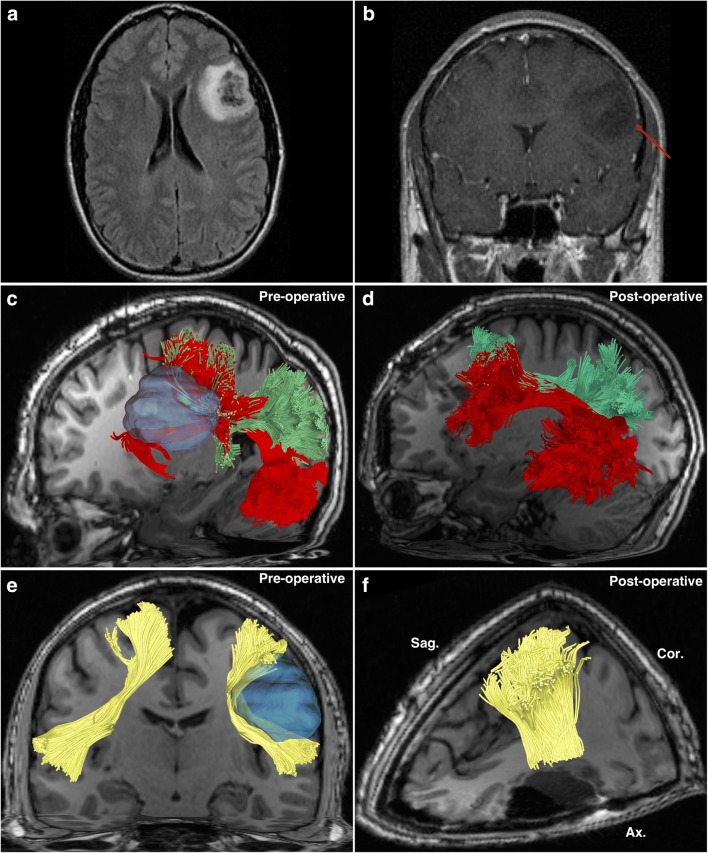 Fig. 4