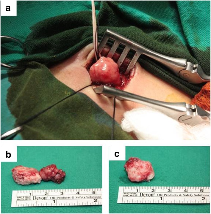 Fig. 2