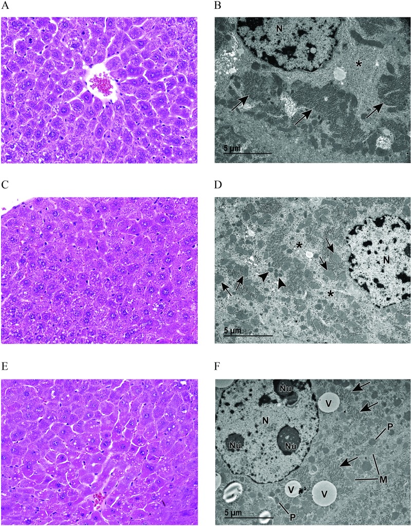 Figures 4A, 4C, and 4E are light microscopic representations, and 4B, 4D, and 4F are transmission microscopic representations of liver from vehicle control and PFOA-exposed pregnant dams.