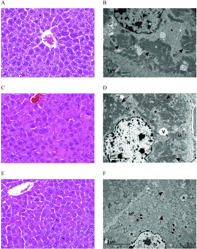 Figures 5A, 5C, and 5E are light microscopic representations, and 5B, 5D, and 5F are transmission microscopic representations of liver from vehicle control and GenX-exposed pregnant dams