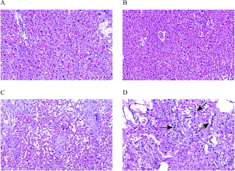 Figures 7A, 7B, 7C, and 7D are microscopic representations of histopathological features of the placenta.