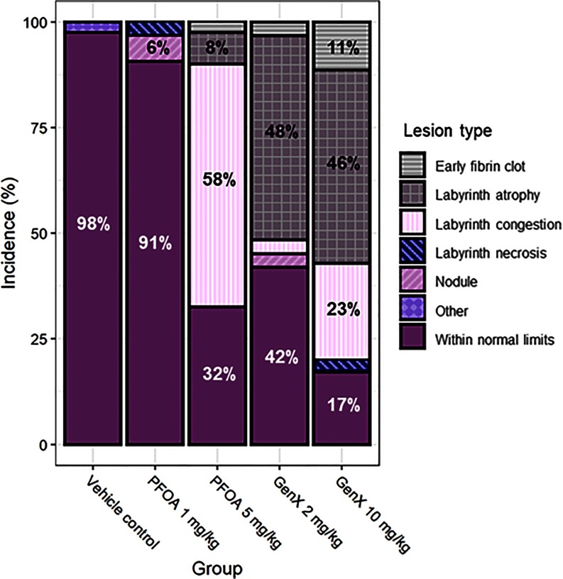 Figure 8 is a bar graph, plotting incidence, ranging from 0 to 100 percent in increments of 25 (y-axis) for lesion types early fibrin clot, labyrinth atrophy, labyrinth congestion, labyrinth necrosis, nodule, other, and within normal limits across group, including vehicle control, PFOA 1 milligram per kilogram, PFOA 5 milligrams per kilogram, GenX 2 milligrams per kilogram, and GenX 10 milligrams per kilogram (x-axis).