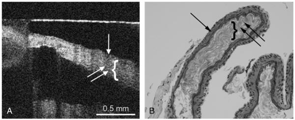 FIG. 3