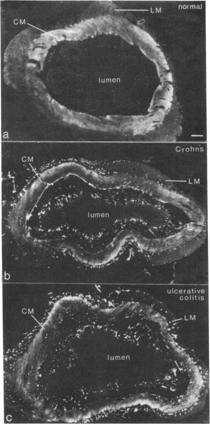 graphic file with name pnas00261-0366-a.jpg