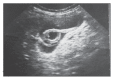 Figure 3b