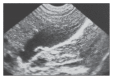 Figure 7a