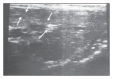 Figure 9a
