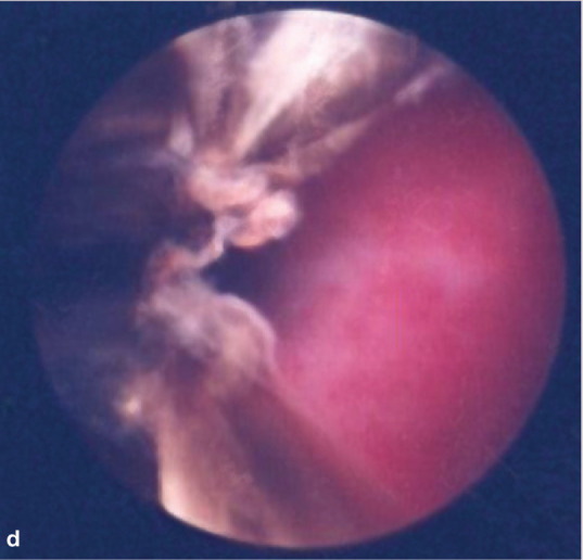 graphic file with name 10.1016_j.jfms.2010.05.006-fig14.jpg