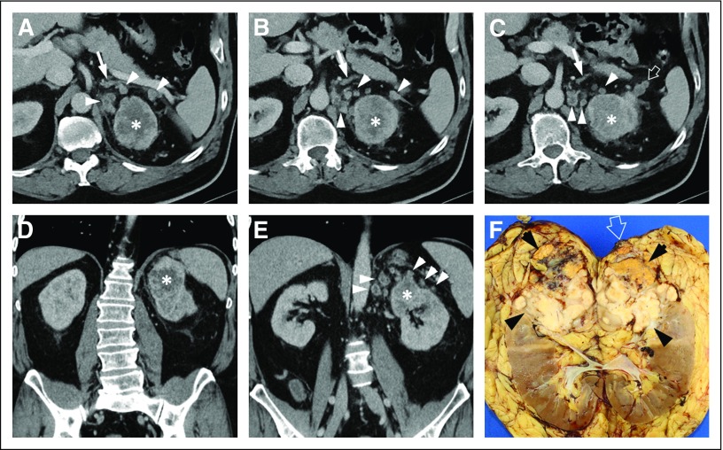 Fig 2.