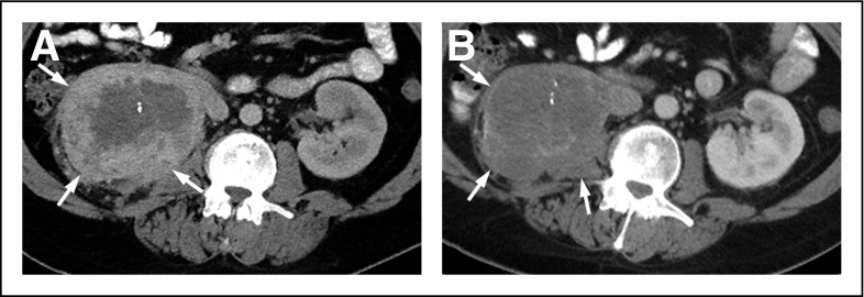 Fig 4.