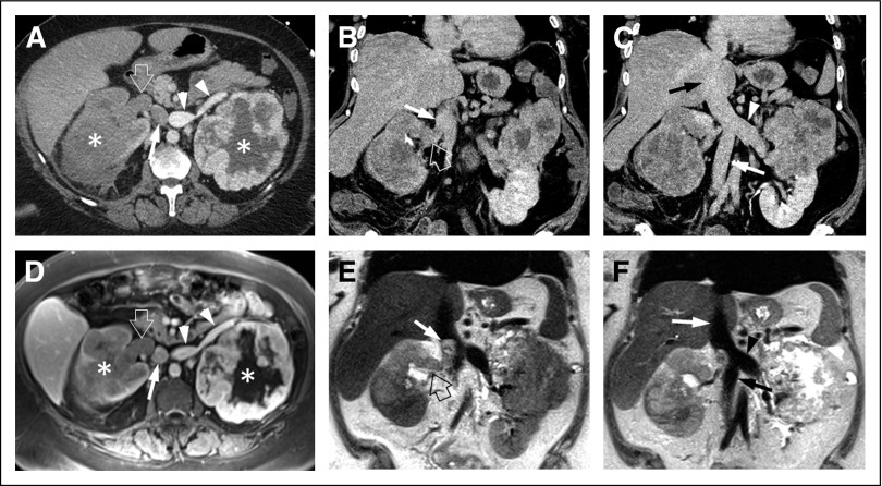 Fig 3.